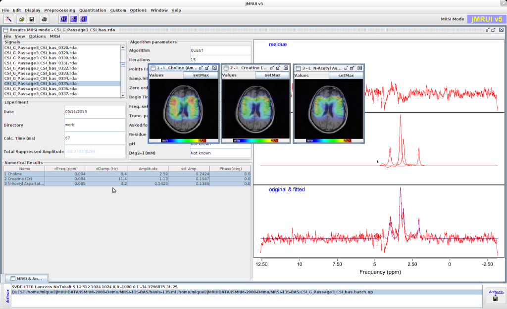 jMRUI v. 5.0 - Human brain MRSI quantitation