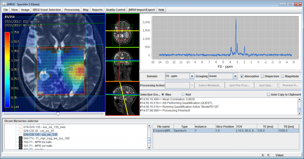 SpectrIm 1.0 beta screentshot